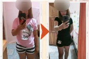 ภาพก่อน–หลัง รีวิวลูกค้าโนบุ 2 (เบลอหน้า)