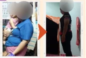 ภาพก่อน–หลัง รีวิวลูกค้าโนบุ 3 (เบลอหน้า)