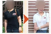 ภาพก่อน–หลัง รีวิวลูกค้าโนบุ 7 (เบลอหน้า)