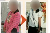 ภาพก่อน–หลัง รีวิวลูกค้าโนบุ 8 (เบลอหน้า)